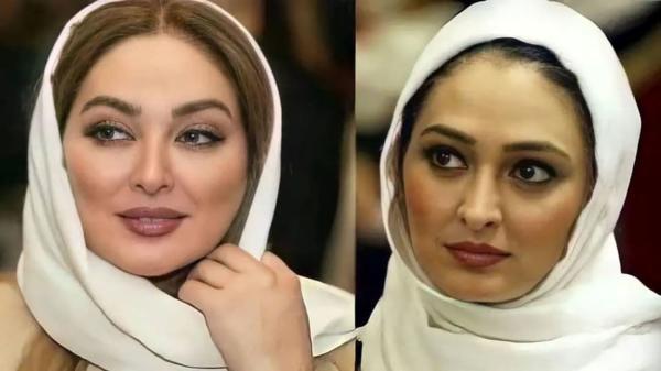 عکس قبل و بعد عمل زیبایی بازیگران زن ایرانی ، چقدر تغییر !
